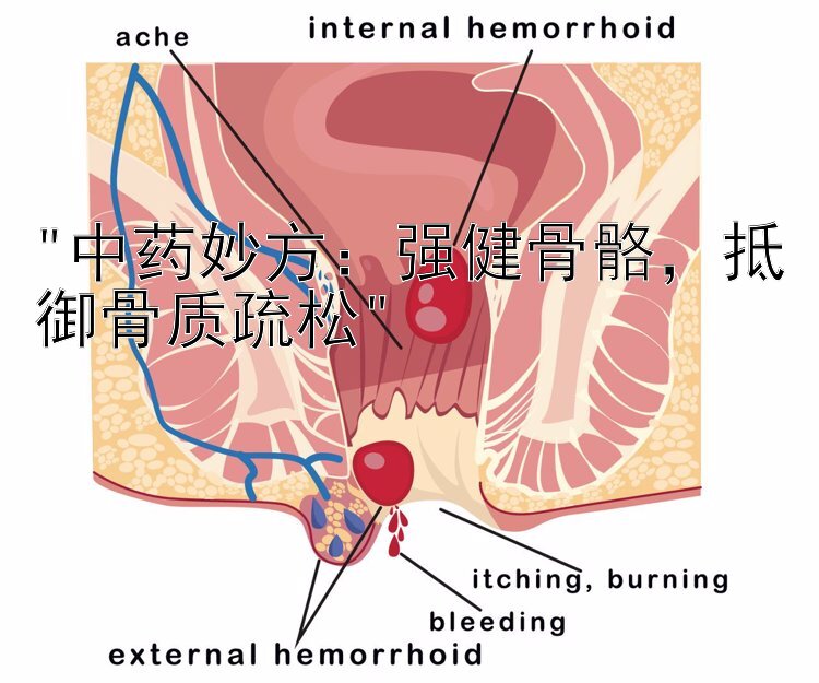 中药妙方：强健骨骼，抵御骨质疏松