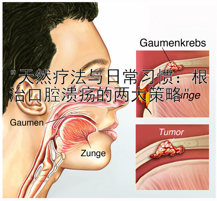 天然疗法与日常习惯：根治口腔溃疡的两大策略