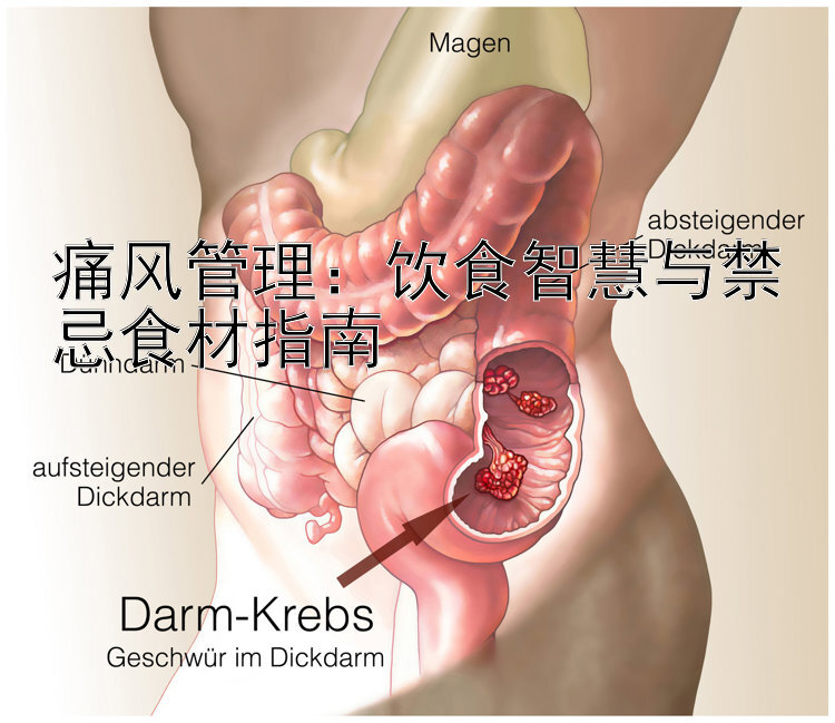 痛风管理：饮食智慧与禁忌食材指南