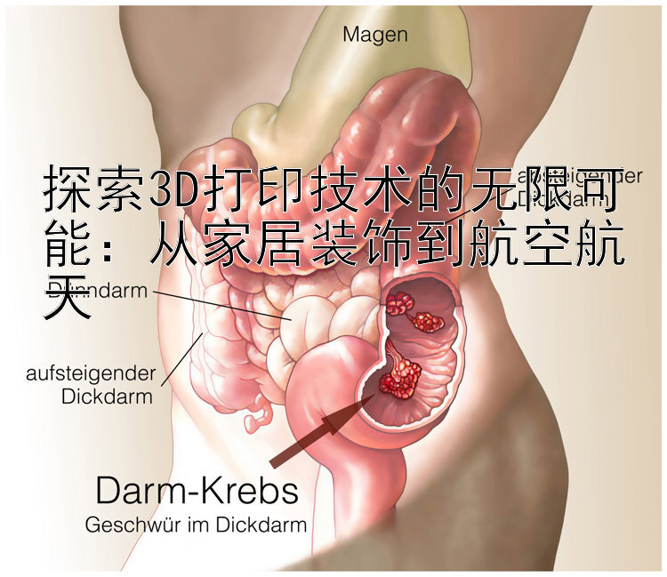 探索3D打印技术的无限可能：从家居装饰到航空航天