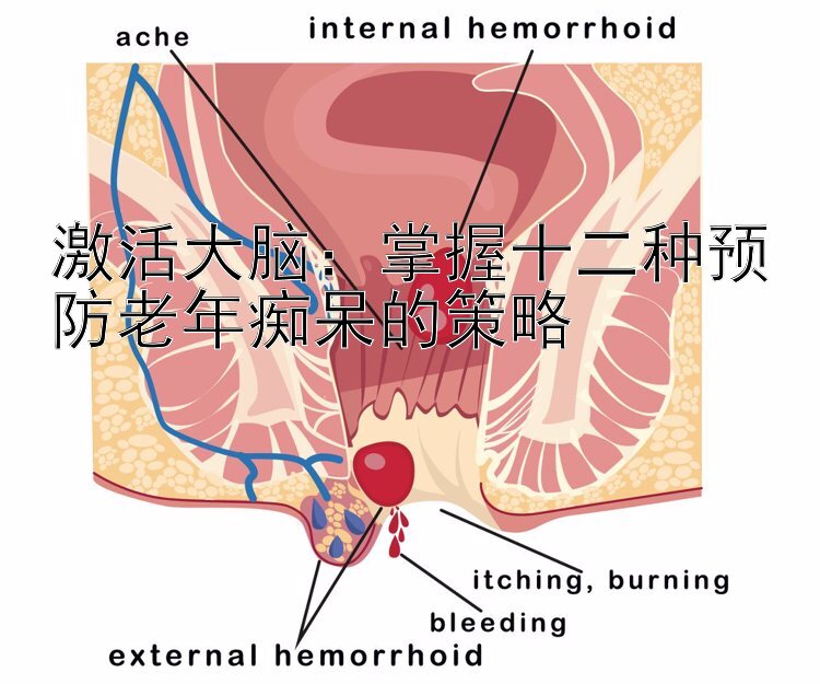 激活大脑：掌握十二种预防老年痴呆的策略