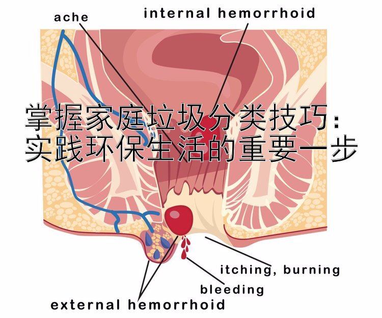 掌握家庭垃圾分类技巧：实践环保生活的重要一步