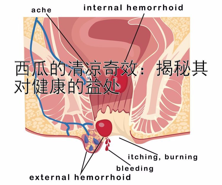 西瓜的清凉奇效：揭秘其对健康的益处