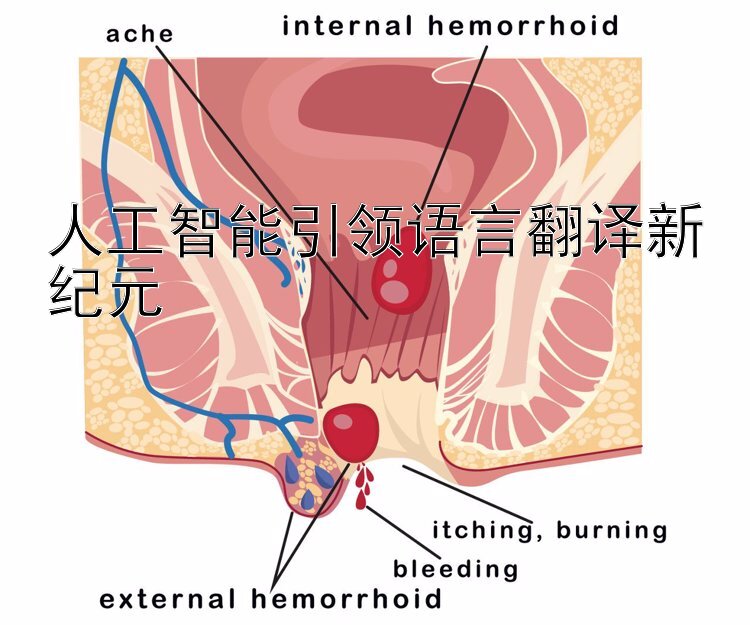 人工智能引领语言翻译新纪元