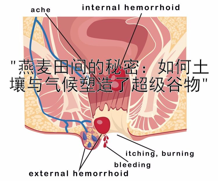 燕麦田间的秘密：如何土壤与气候塑造了超级谷物