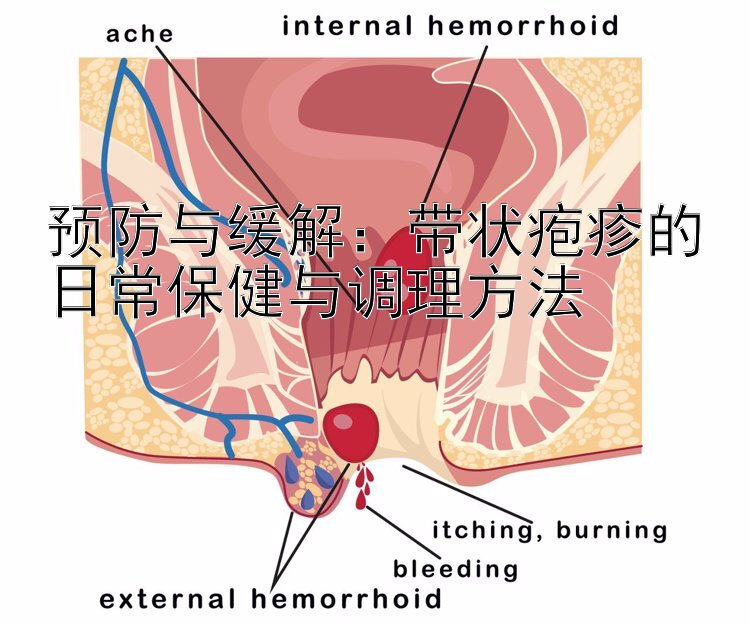 预防与缓解：带状疱疹的日常保健与调理方法